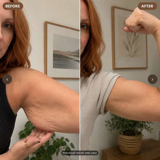 VYORÉNA SCULPT™ | 3-in-1 Body Sculpting Device